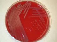 Bordetella bronch blood