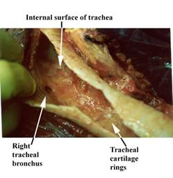 Anat Tracheal bronchus label.JPG