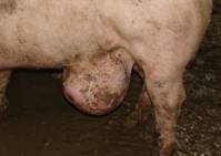 Umbilical hernia kr 2