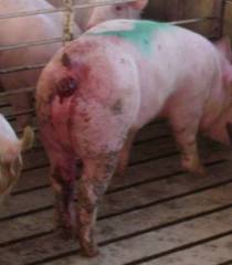Rectal prolapse stricture